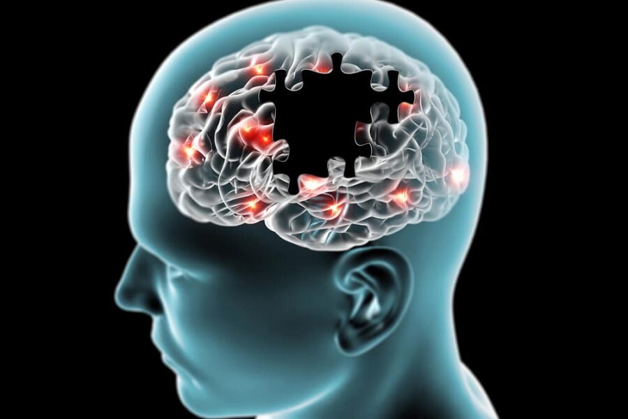 Desvendando o Alzheimer: Pesquisa Revela o Papel do Gene BIN1